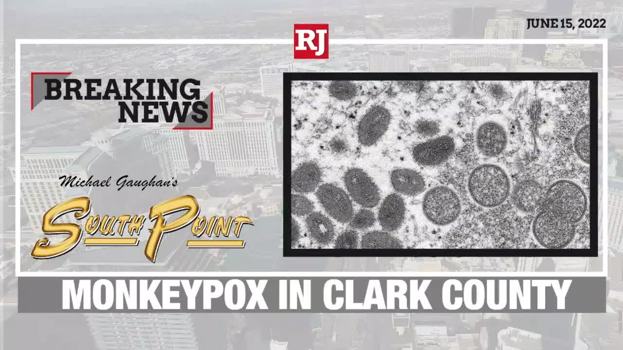 Monkeypox Reaches Clark County