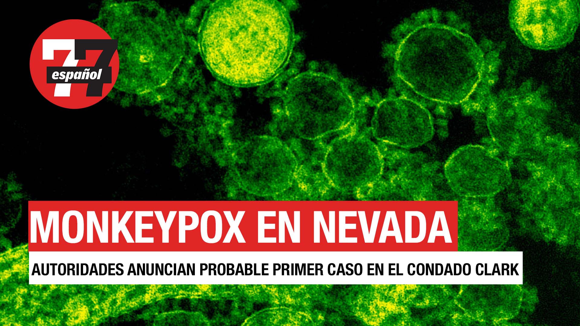 Noticias de Las Vegas | primer caso de monkeypox en Nevada y aumento de millaje