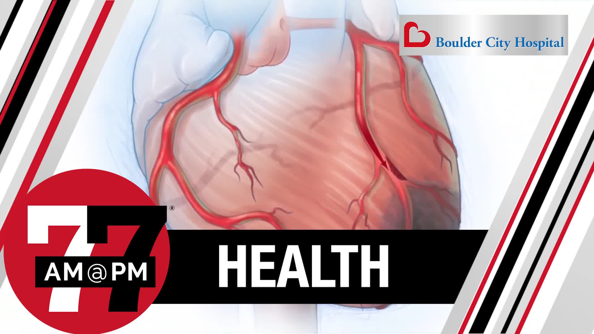 Coronary artery disease most common heart condition in the U.S.