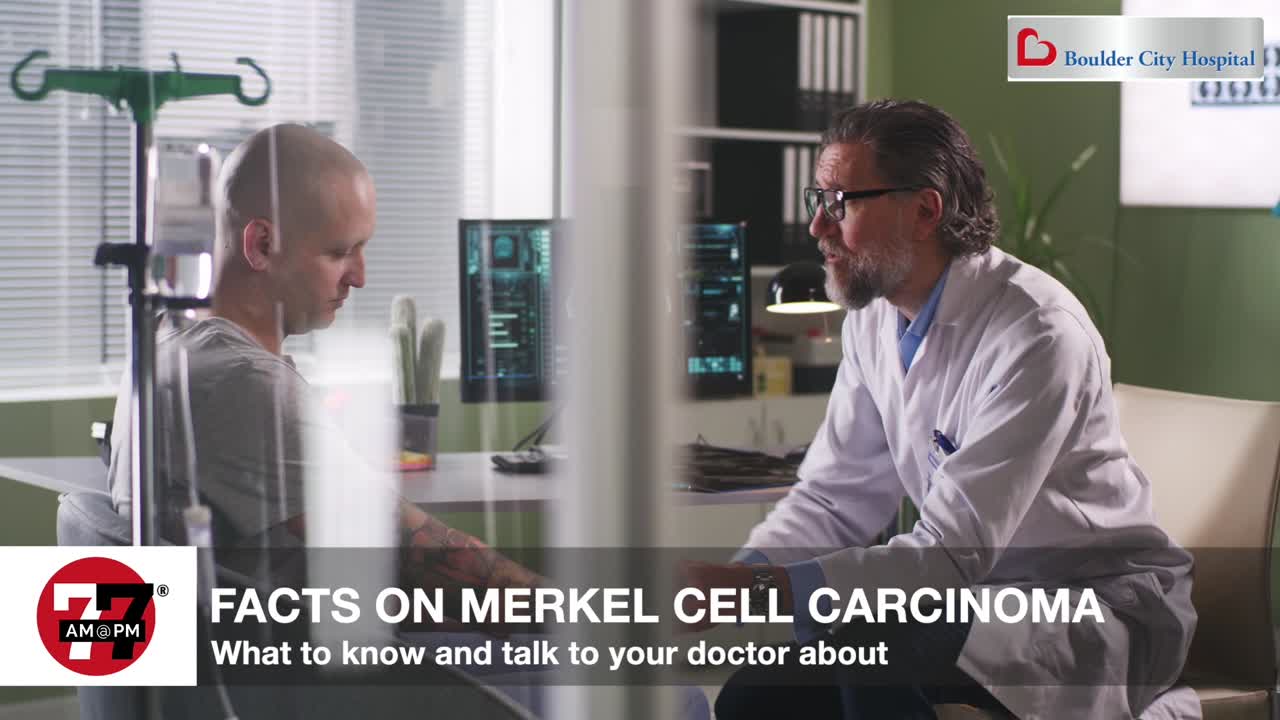 Facts on Merkel cell carcinoma