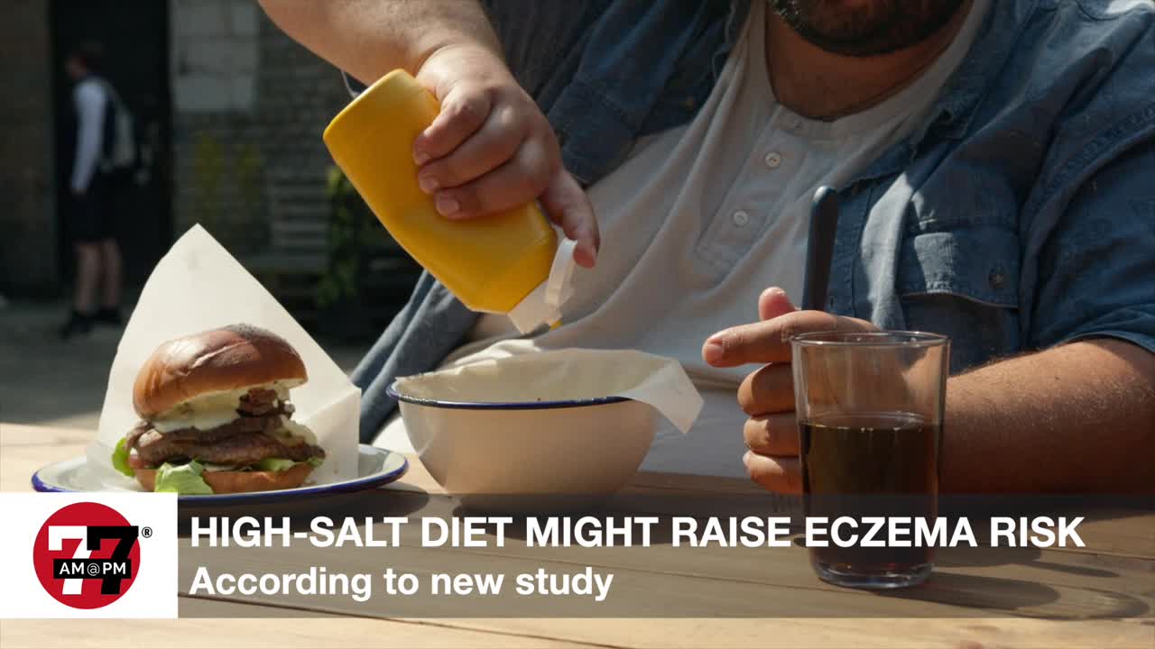 High-salt diet might raise eczema risk