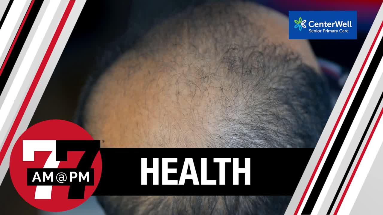 What food and drinks contribute to hair loss?