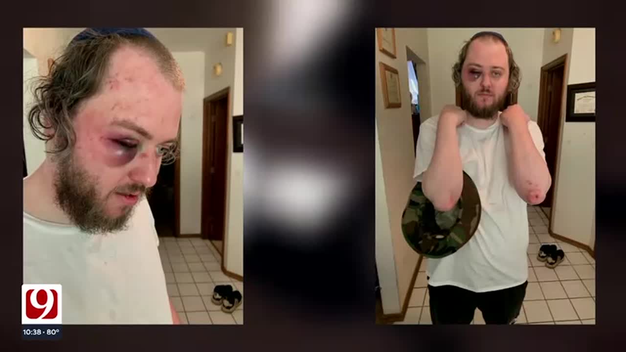 Norman Police Investigating Possible Hate Crime Attack On Campus Corner