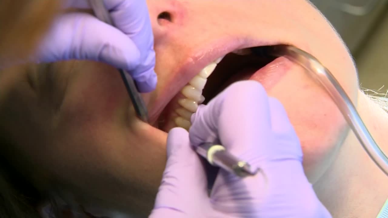 Gum disease could be linked to an increased risk of stroke and brain ...