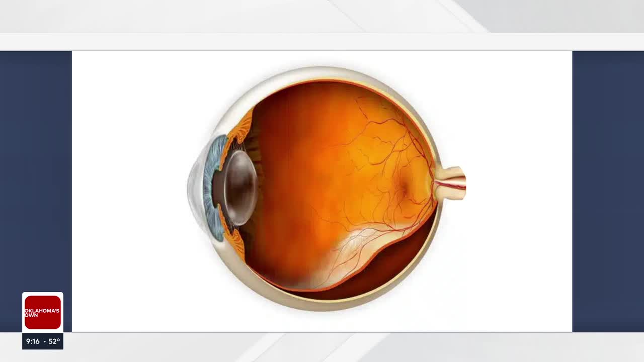 Q&A: How does aging affect vision?